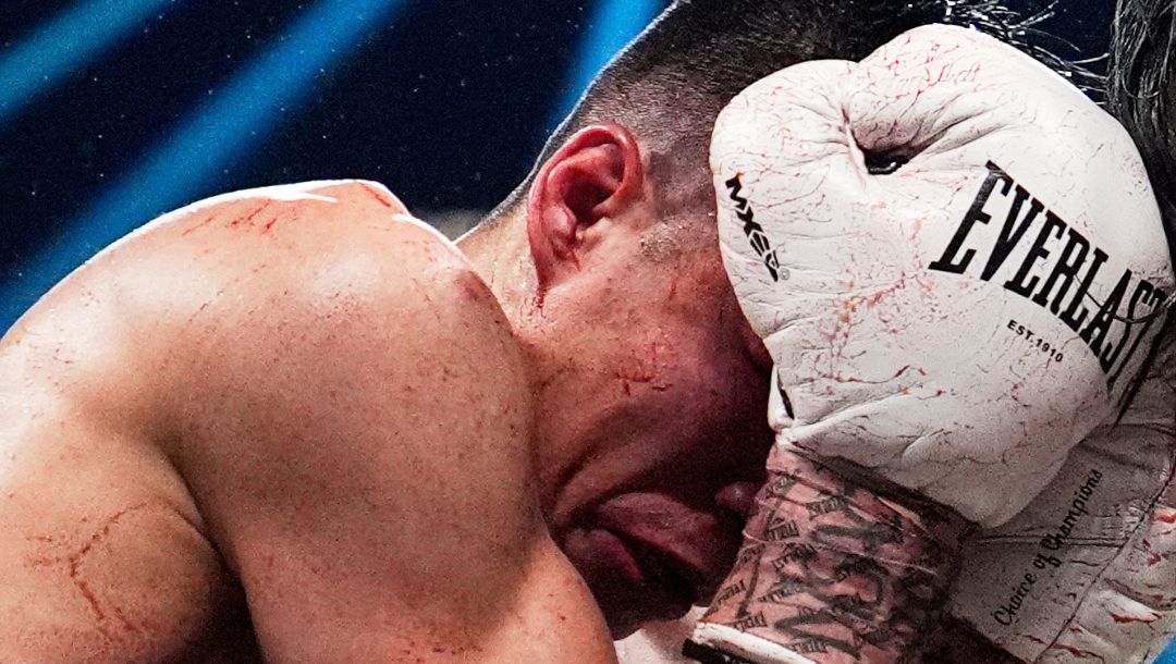 Joet Gonzalez, left, fights Brandon Figueroa in a featherweight boxing match Saturday, July 19, 2025, in Las Vegas.